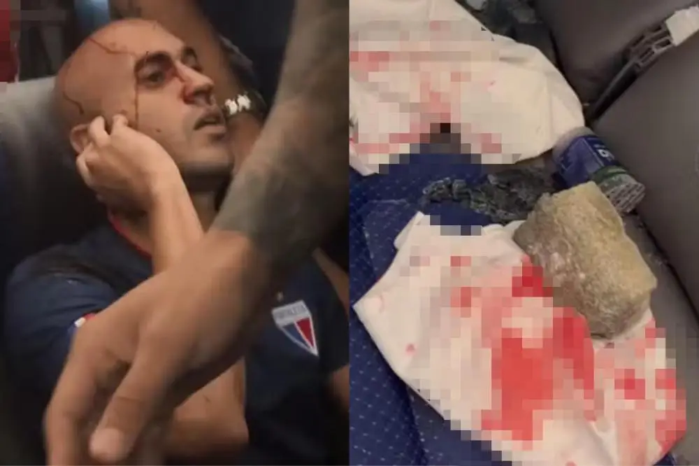 Foto: Reprodução/Redes Sociais