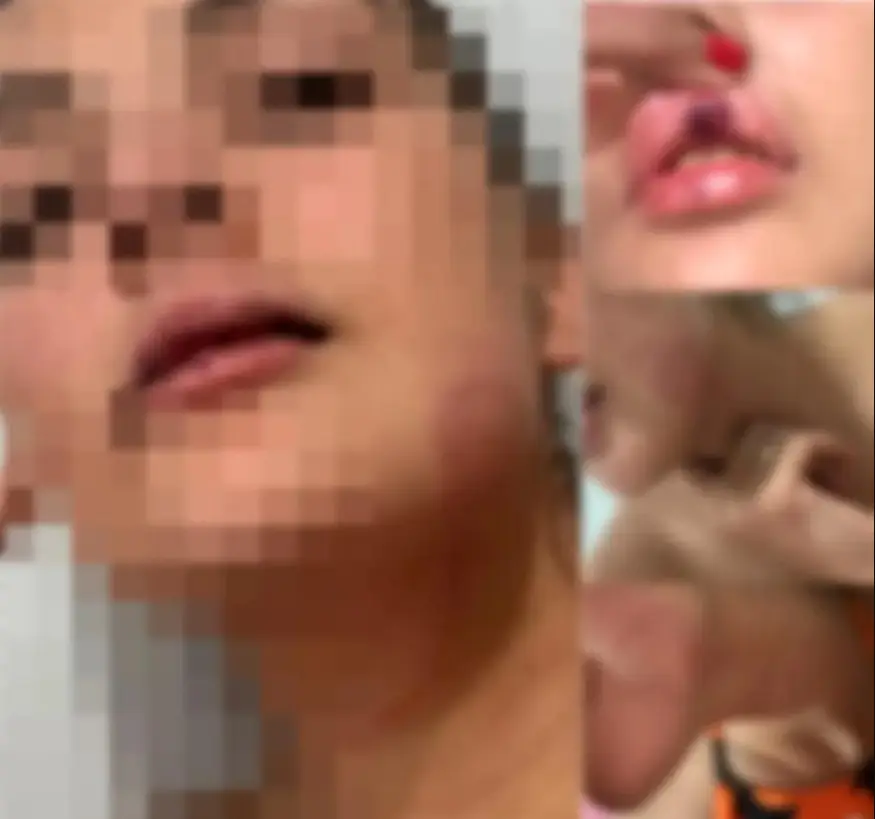 Foto: Reprodução/Redes Sociais