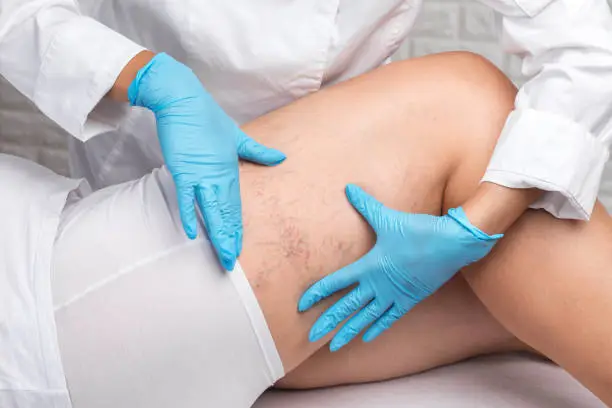 Foto: iStock