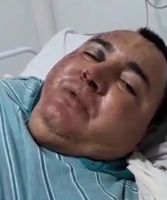 Foto: Reprodução/Redes sociais 