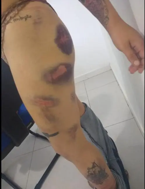 Mulher é torturada por ex-namorado em Icoaraci, distrito de Belém — Foto: MPPA