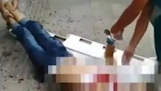 Vítima de ataque a tesouradas na China (Foto: Reprodução/JSTV)