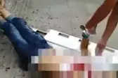 Vítima de ataque a tesouradas na China (Foto: Reprodução/JSTV) (Foto: Jornal Extra)