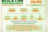  (Foto: Prefeitura de Água Branca/ SECOM)