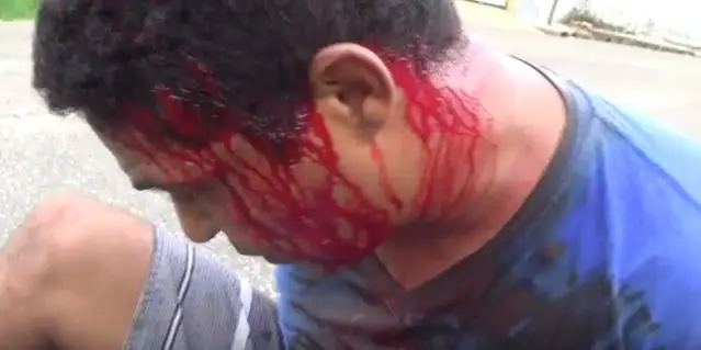 Agredido por populares após assalto