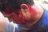 Agredido por populares após assalto (Foto: Portal Somos Notícia )