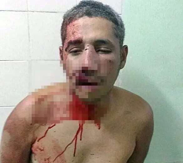 Acusado agredido por populares (Foto: Folha de Parnaíba)