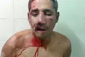 Acusado agredido por populares (Foto: Folha de Parnaíba) (Foto:  Folha de Parnaíba)