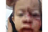 Foto: Reprodução (Foto: Piauí em Foco)