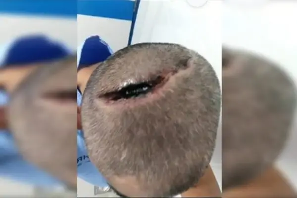 Reprodução